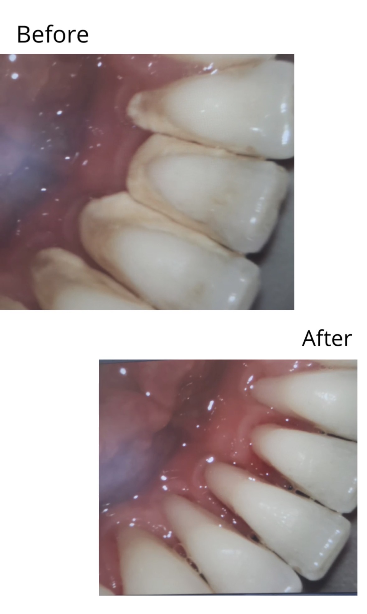 Before and after cleaning result